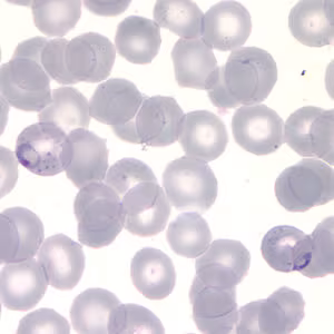 December - 2007 - Case #217