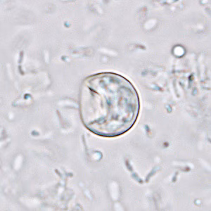 Case233_A