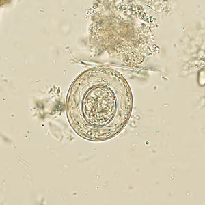 Case270_B.jpg