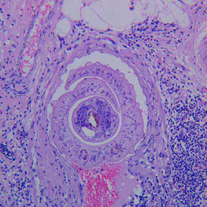 March - 2010 - Case #272