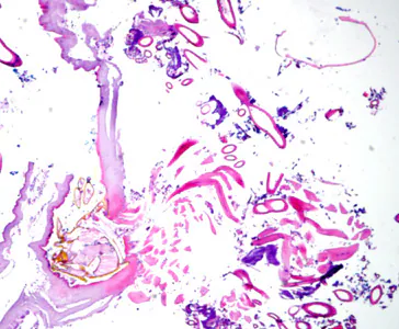 May - 2010 - Case #275