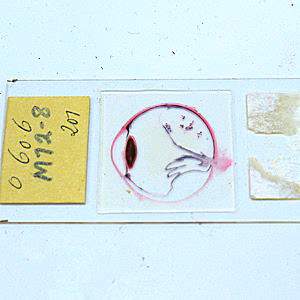 June - 2010 - Case #278