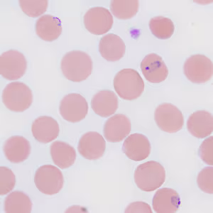 November - 2010 - Case #287