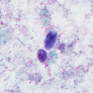 February - 2011 - Case #293