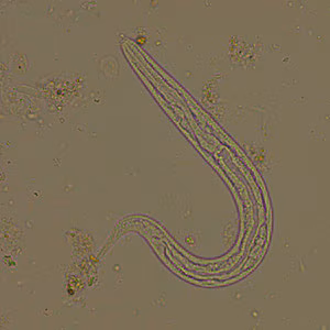 February - 2011 - Case #294