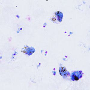 March - 2011 - Case #295