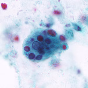 March - 2011 - Case #296