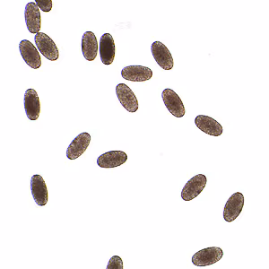 April - 2011 - Case #297