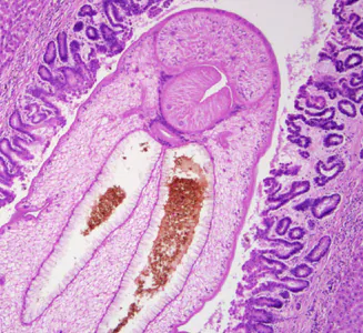 May - 2011 - Case #299