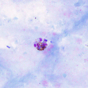 June - 2011 - Case #302