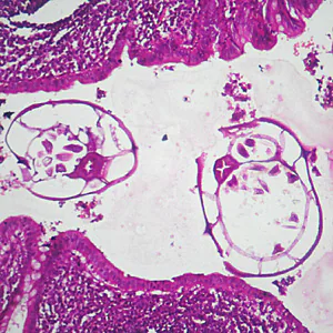 August - 2011 - Case #305