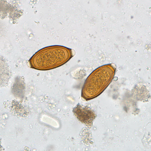 September - 2011 - Case #307