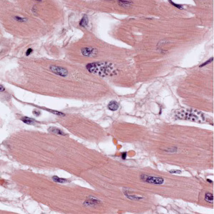 September - 2011 - Case #308