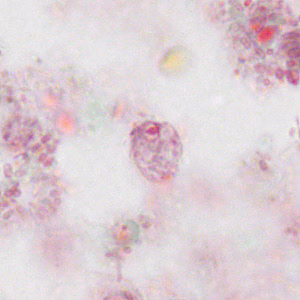 October - 2011 - Case #310