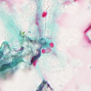 November - 2011 - Case #312