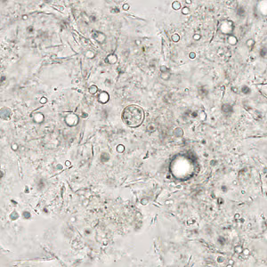 December - 2011 - Case #313