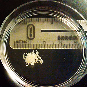 December - 2011 - Case #314