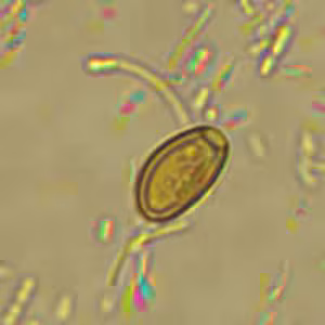 February - 2012 - Case #318