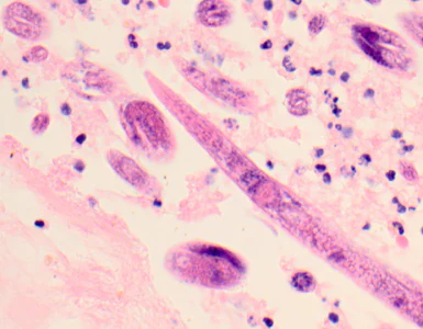 March - 2012 - Case #319