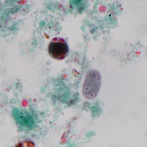 March - 2012 - Case #320