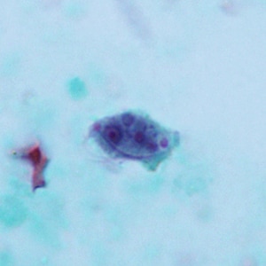 April - 2012 - Case #322