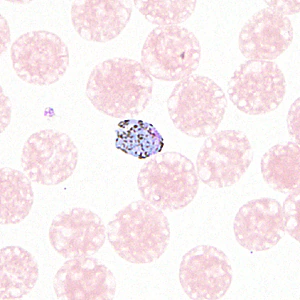 August - 2012 - Case #330