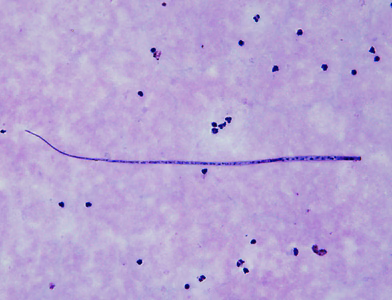 January - 2013 - Case #339