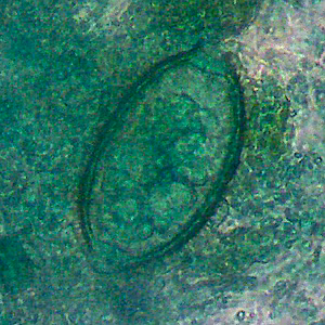 March - 2013 - Case #343