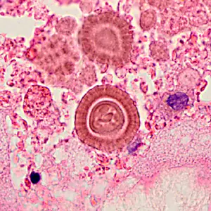 April - 2013 - Case #345