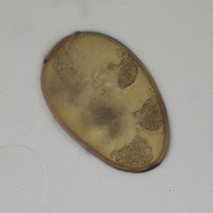 May - 2013 - Case #348