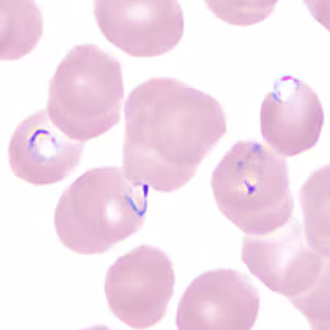 June - 2013 - Case #350