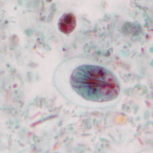 July - 2013 - Case #351