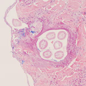 July - 2013 - Case #352