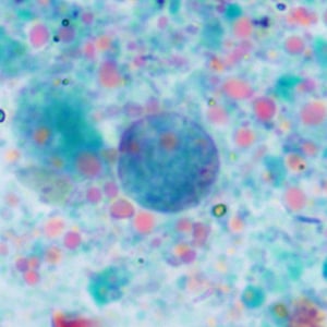 November - 2013 - Case #360