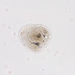 February - 2014 - Case #366