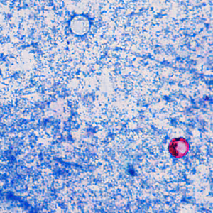 June - 2014 - Case #374