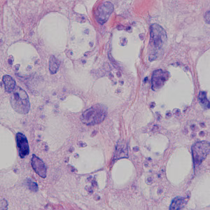 August - 2014 - Case #378