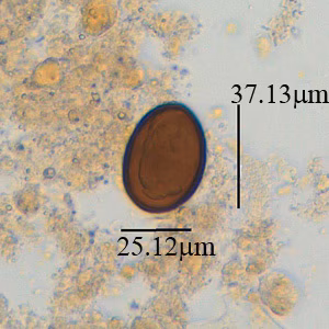 October - 2014 - Case #381