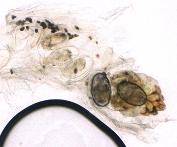 November - 2014 - Case #383