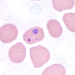 December - 2014 - Case #385