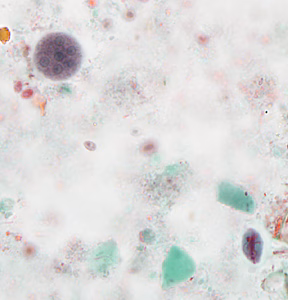 December- 2014 - Case #386