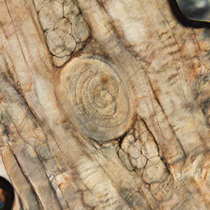 February - 2015 - Case #389