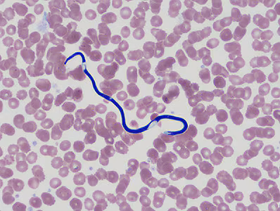 February - 2015 - Case #390