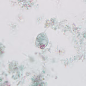 May - 2015 - Case #395