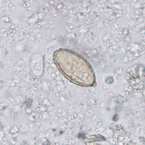 August - 2015 - Case #402