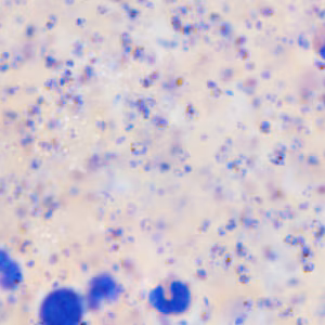 September - 2015 - Case #403