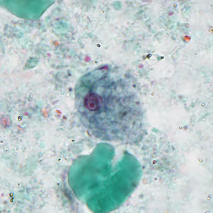 September - 2015 - Case #404