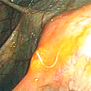 January - 2016 - Case #411