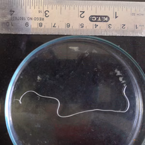 January - 2016 - Case #412