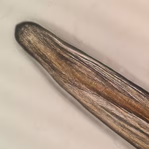 Case412_B.jpg Figure B